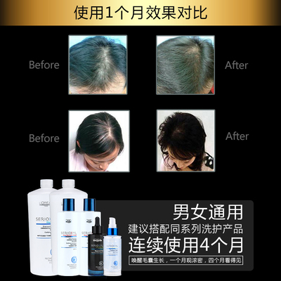 科技賦能防脫，歐萊雅芯基源洗護(hù)套裝 深入發(fā)芯，重塑強(qiáng)韌發(fā)絲