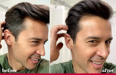 年紀輕輕就長白頭發？從沐浴用品到生活方式的全方位應對指南